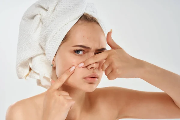 Vacker kvinna med en handduk på mitt huvud ansiktsbehandling hudproblem ljus bakgrund — Stockfoto