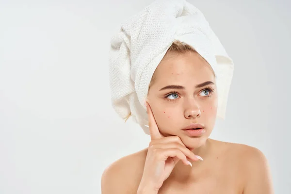 Mujer hombros desnudos tratamiento del acné Estudio de cerca — Foto de Stock
