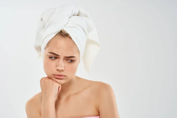 Schöne Frau mit einem Handtuch auf dem Kopf Gesichtshaut Hautprobleme Dermatologie — Stockfoto