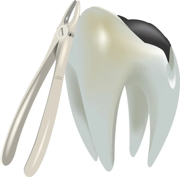 Molar tand med karies — Stock vektor