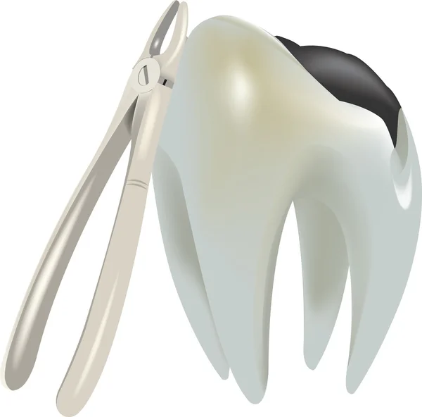 Diente molar con caries — Vector de stock