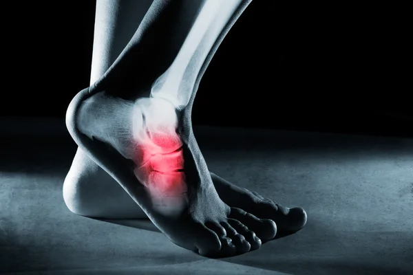 Pie humano tobillo y pierna en rayos X —  Fotos de Stock