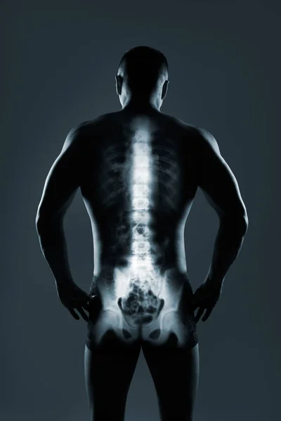 Menschliche Wirbelsäule im Röntgenbild auf grauem Hintergrund — Stockfoto