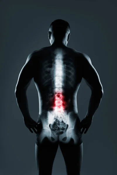 Menschliche Wirbelsäule im Röntgenbild auf grauem Hintergrund. — Stockfoto