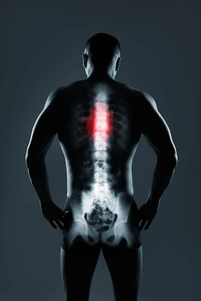 Mänsklig ryggrad i röntgen på grå bakgrund. — Stockfoto