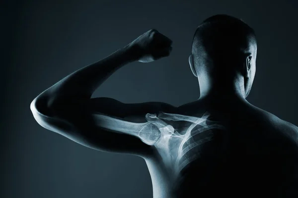 Articulación del hombro humano en rayos X sobre fondo gris —  Fotos de Stock