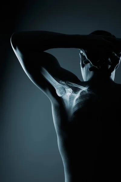 Людський плечовий суглоб у рентгенівському промені на сірому фоні — стокове фото