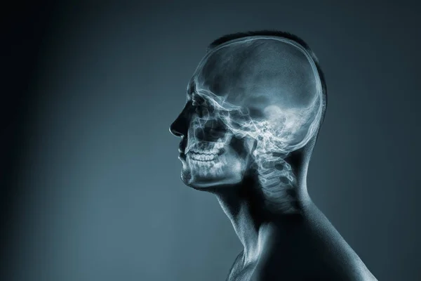 Rayos X de una cabeza de hombre. Examen médico de lesiones en la cabeza. —  Fotos de Stock