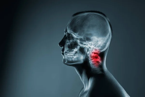 Röntgenbild eines Mannes Kopf. Medizinische Untersuchung der Kopfverletzungen. — Stockfoto