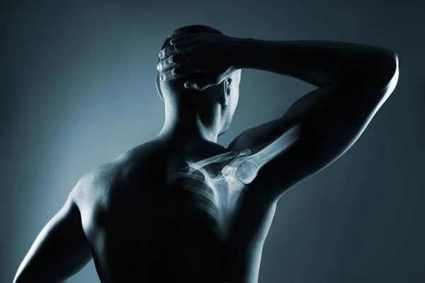 Articulación del hombro humano en rayos X sobre fondo gris —  Fotos de Stock