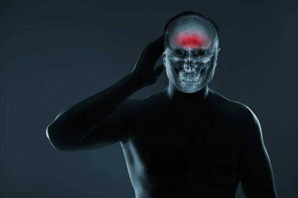 머리의 엑스레이요 부상에 의학적 뇌출혈이야 앞부분 부분은 빨간색으로 강조되어 포트폴리오에 — 스톡 사진