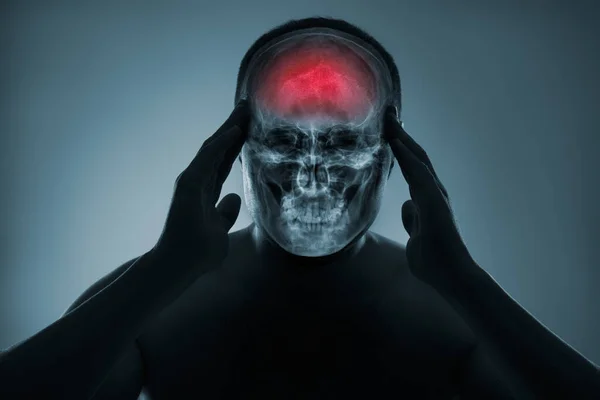Rayos Cabeza Hombre Examen Médico Lesiones Cabeza Ataque Cerebral Daño —  Fotos de Stock