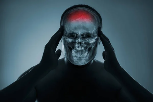 머리의 엑스레이요 부상에 의학적 뇌출혈이야 뒷부분은 색으로 강조되어 포트폴리오에 엑스레이 — 스톡 사진