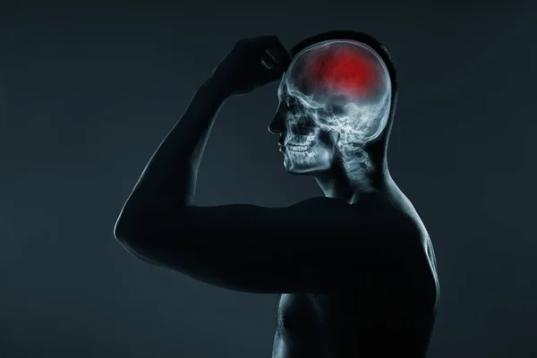 Röntgen Egy Férfi Fejéről Fejsérülések Orvosi Vizsgálata Agyvérzés Agykárosodást Vörös — Stock Fotó