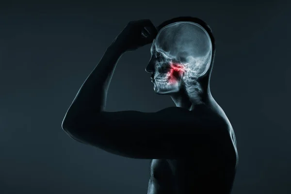 Rayos X de una cabeza de hombre. Examen médico de lesiones en la cabeza. —  Fotos de Stock