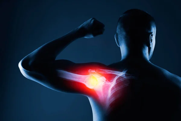 Human shoulder joint in x-ray on blue background — Stock Photo, Image