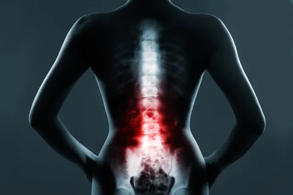 The lumbar spine is highlighted by red colour — Stock Image The lumbar spine is highlighted by red colour Royalty Free Stock Images