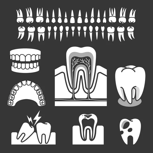 Anatomie lidského zubu. Vektorové ilustrace. — Stockový vektor