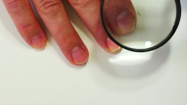 Examinar las uñas de la mano con una lupa para la prevención de enfermedades. — Vídeo de stock