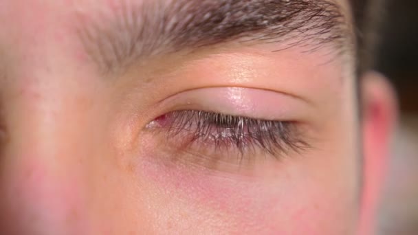 Großaufnahme männlicher Augen, die Angst bekommen — Stockvideo