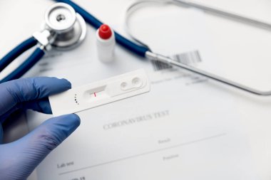 Covid-19 testi. IgM / IgG antikorları için kaset testi. Coronavirus önleme