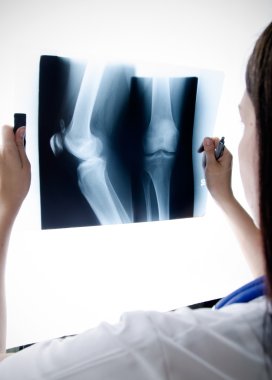 Doktor hastane röntgen resim dizime bakarak