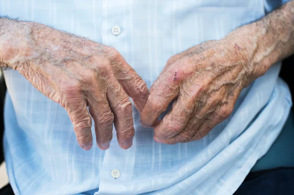 Hände eines älteren Mannes — Stockfoto