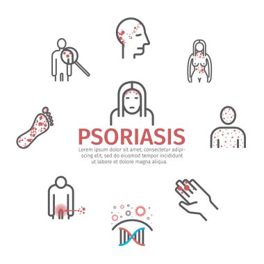 Psoriasis. Symptoms, Treatment. Line icons set. Vector signs for web graphics. clipart