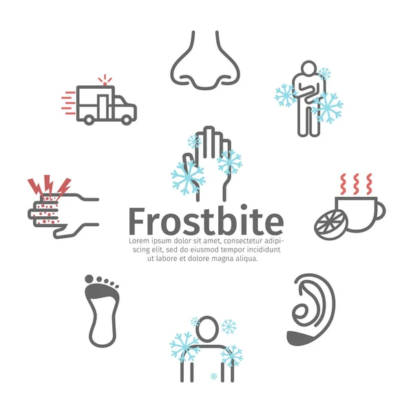 Frostbite Symptoms Line Icons Set Vector Signs Web Graphics — Stock Vector
