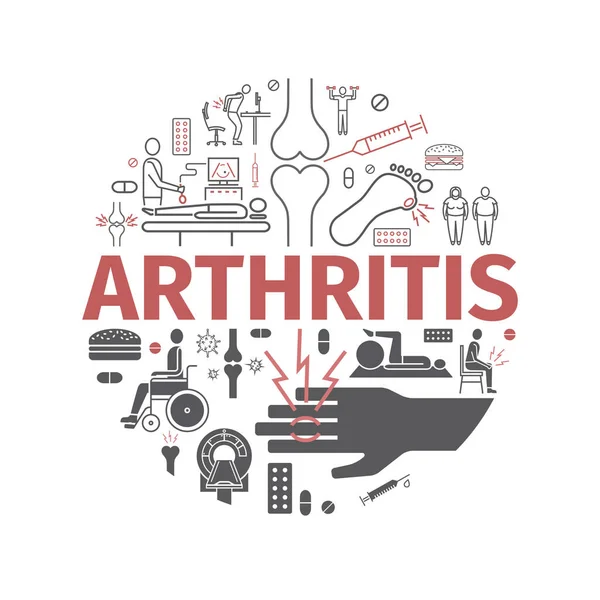 Artritis Síntomas Tratamiento Juego Iconos Línea Signos Vectoriales Para Gráficos — Vector de stock