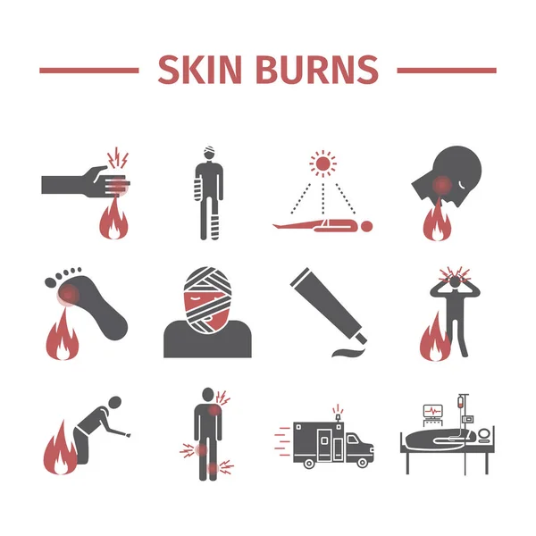 Skinl Burns Kine Ikonok Kezelés Vektor Illusztrációk Vektorjelek Webes Grafikához — Stock Vector