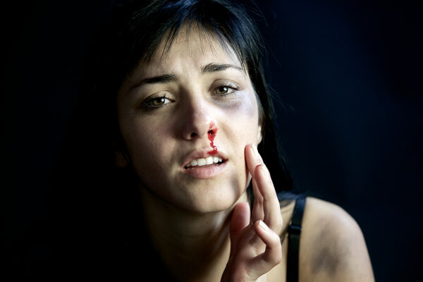 Young woman nose bleeding