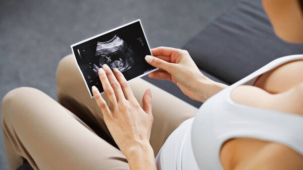 cropped view of pregnant woman holding ultrasound scan on blurred foreground