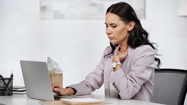 Allergic Businesswoman Feeling Unwell Laptop Desk — Stock fotografie