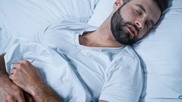 Junger bärtiger Mann schläft zu Hause auf weißem Bettzeug — Stockfoto