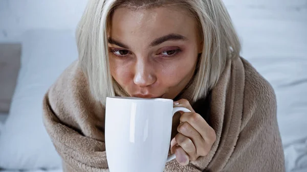 Jovem doente mulher bebendo bebida quente no quarto — Fotografia de Stock