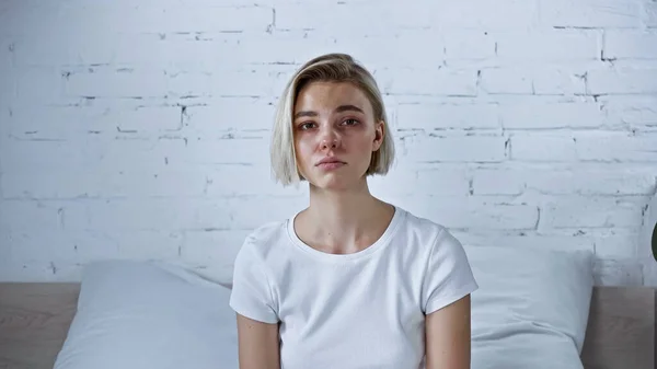 Displeased sick woman looking at camera in bedroom — Stock Photo