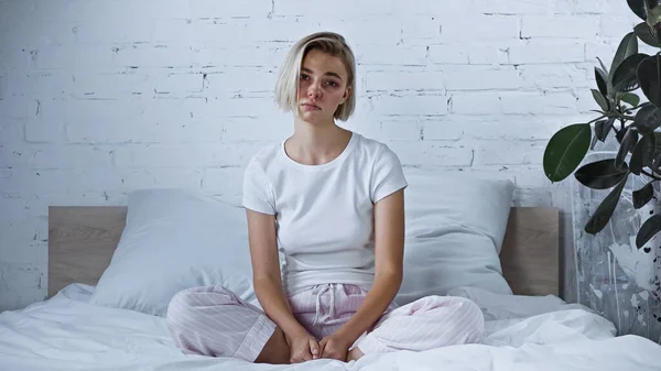 Dissatisfied diseased woman in pajamas looking at camera in bedroom — Stock Photo