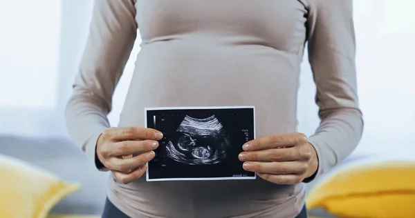 Vista cortada da mulher grávida mostrando ultra-som do bebê — Fotografia de Stock