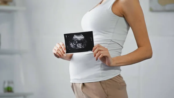 Visão parcial da mulher grávida mostrando ultra-som do bebê — Fotografia de Stock