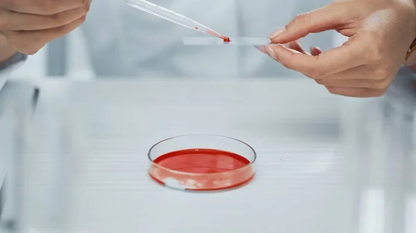 Частковий вигляд афроамериканського вченого, який приймає кров з тестової пластини з піпеткою — стокове фото