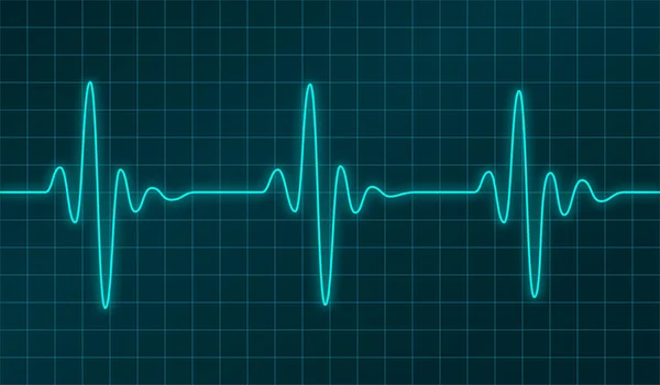 Cardiograma vectorial — Vector de stock