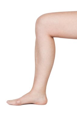 Women's leg with aching joints clipart