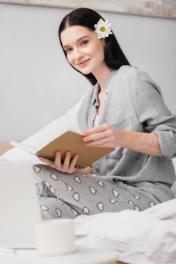 cheerful woman with vitiligo holding notebook near cup on blurred foreground clipart