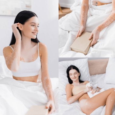 Vitiligo 'lu neşeli kadın kolajı yatakta uzanıyor ve kitap tutuyor.