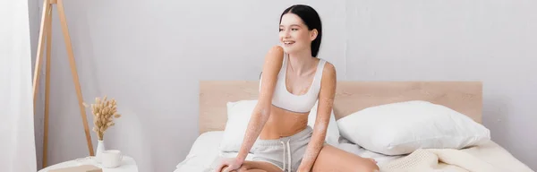 Glad Kvinna Med Vitiligo Leende Medan Sitter Sängen Banner — Stockfoto