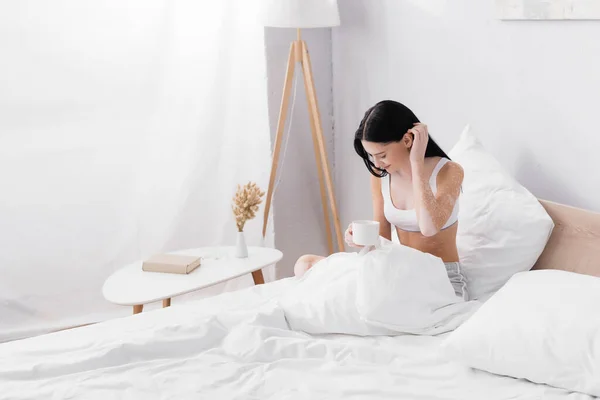 Smiling Woman Vitiligo Holding Cup Coffee While Fixing Hair Bed — Stock Photo, Image