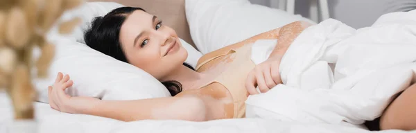 Young Happy Woman Vitiligo Lying Bed Blurred Foreground Banner — Stock Photo, Image