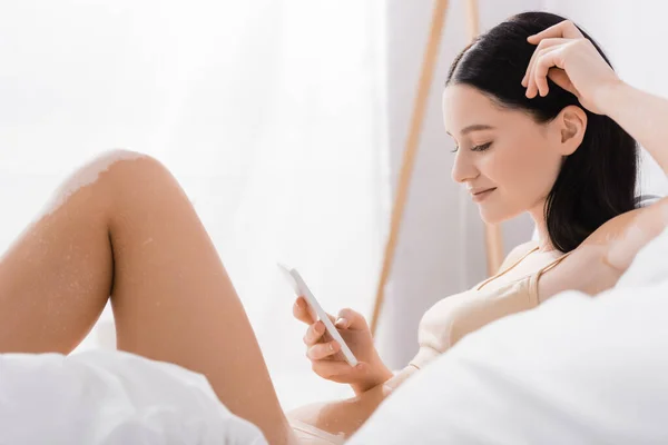 Pleased Woman Vitiligo Using Smartphone Bedroom — Stock Photo, Image