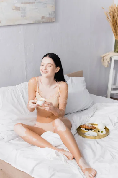 一位快乐的女人 头戴白癜风 躺在床上 手里拿着一杯早餐盘 — 图库照片